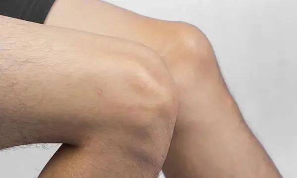 
女人老不老 不能只看年事 下半身若无4个丑态 年轻易长寿“熊猫体育”(图1)